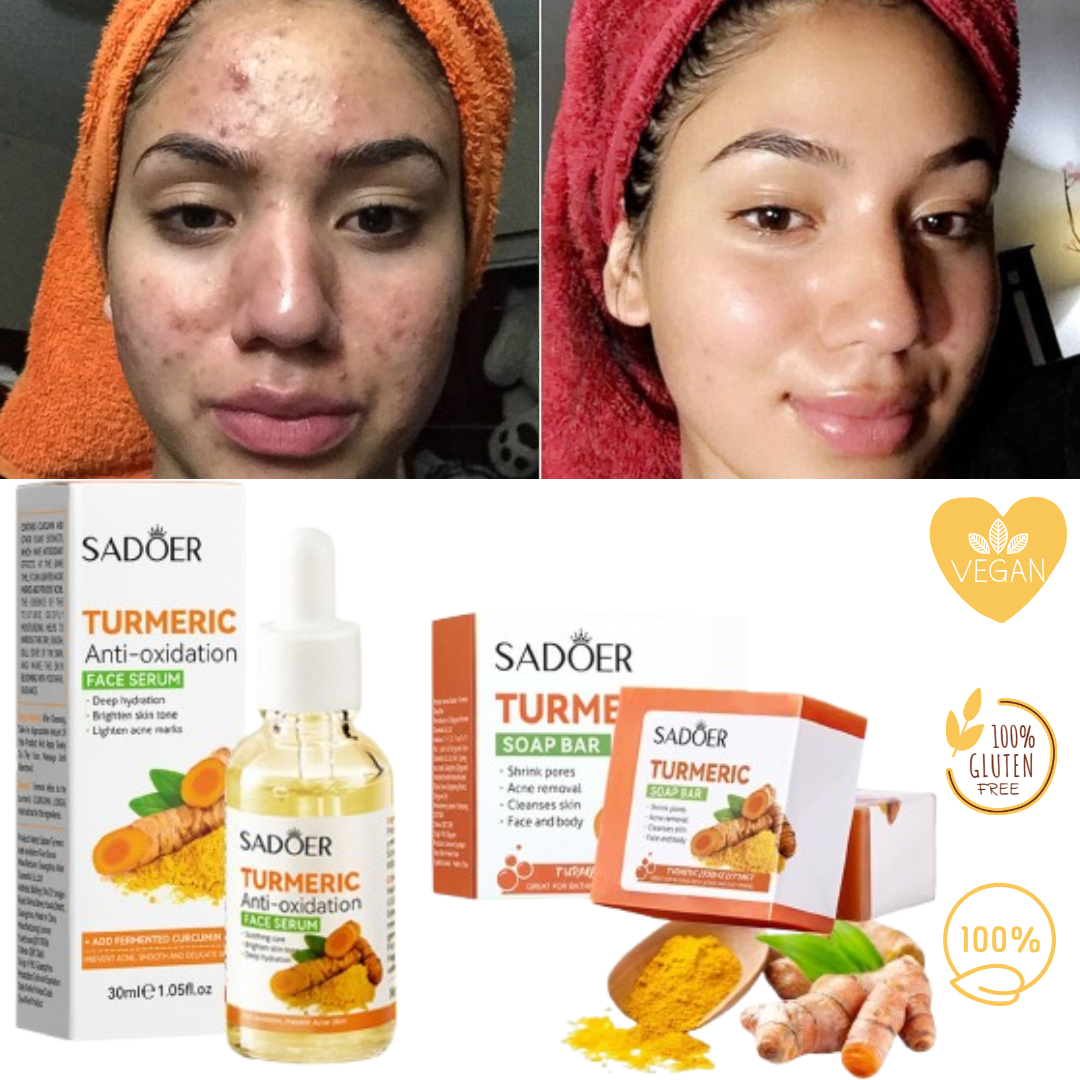 100% Natural Turmeric Soap Bar - For Every Skin