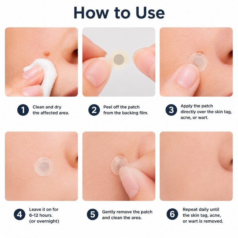 Set of microneedle blemish patches with packaging displayed neatly