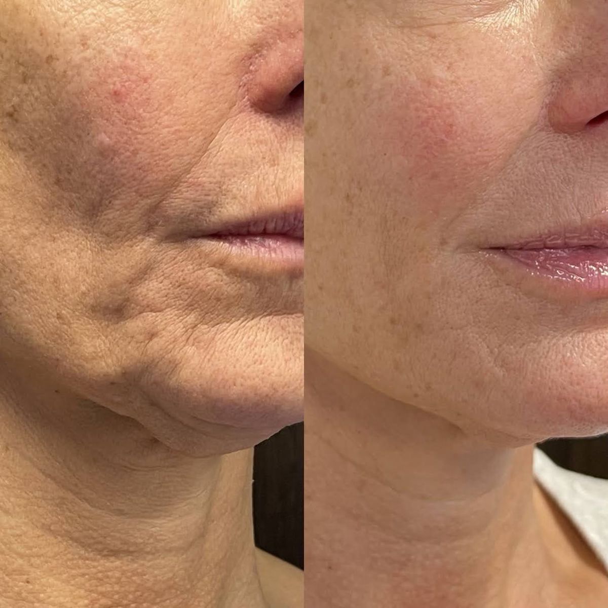 Serum stick applicator close-up for firmer, smoother-looking skin