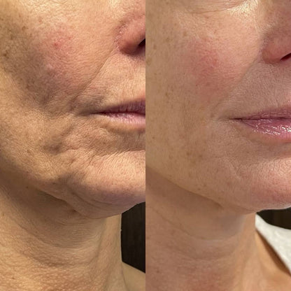 Serum stick applicator close-up for firmer, smoother-looking skin