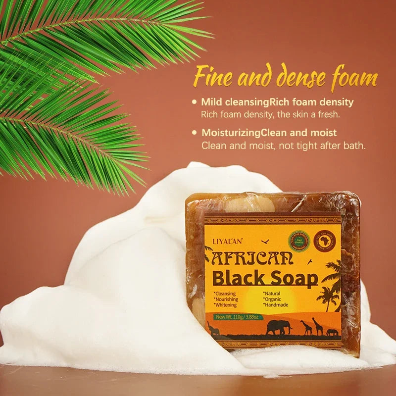 African Black Soap With Organic Shea Butter For Acne Prone Skin 100g