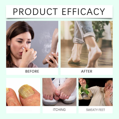 2PCS Foot Sanitizer Spray with Tea Tree Oil,Clear Foot Sanitizer Sprays,Tea Tree Oil Feet Spray, Foot & Shoe Freshness,Quick-Drying & Travel-Friendly,100 ml/3.5 oz