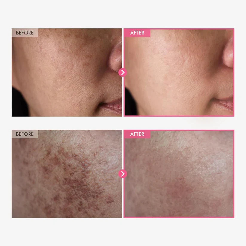 Close-up of arbutin brightening cream in its skincare jar