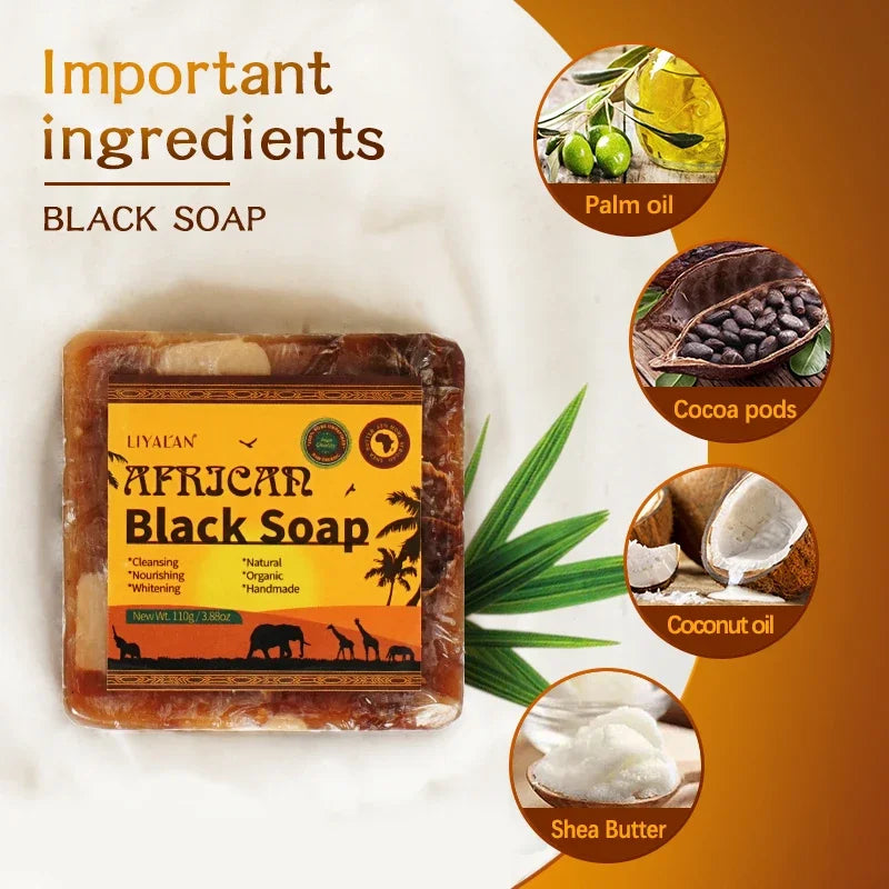 African Black Soap With Organic Shea Butter For Acne Prone Skin 100g