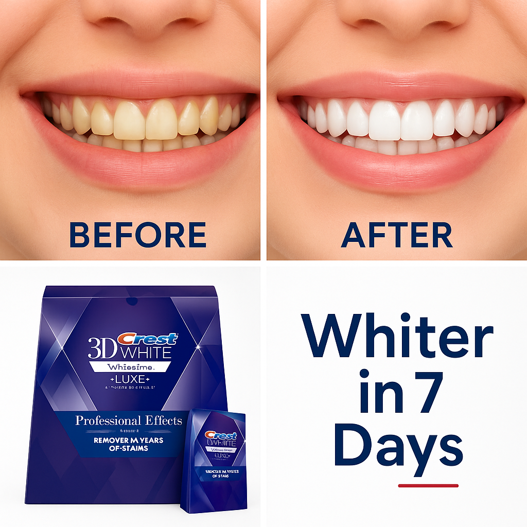 Crest 3D Whitestrips – 12 Level Whiter in 7 Days