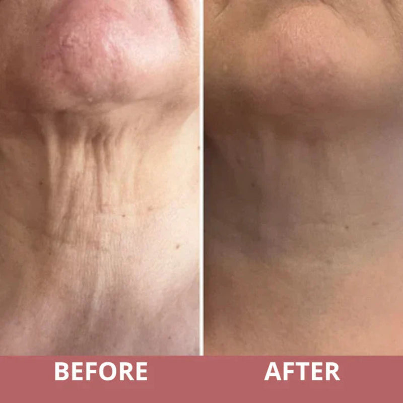 Woman applying neck firming serum with roller applicator to the neck area