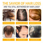 Biotin Scalp Spray Leave In For Thinning Hair 30ml
