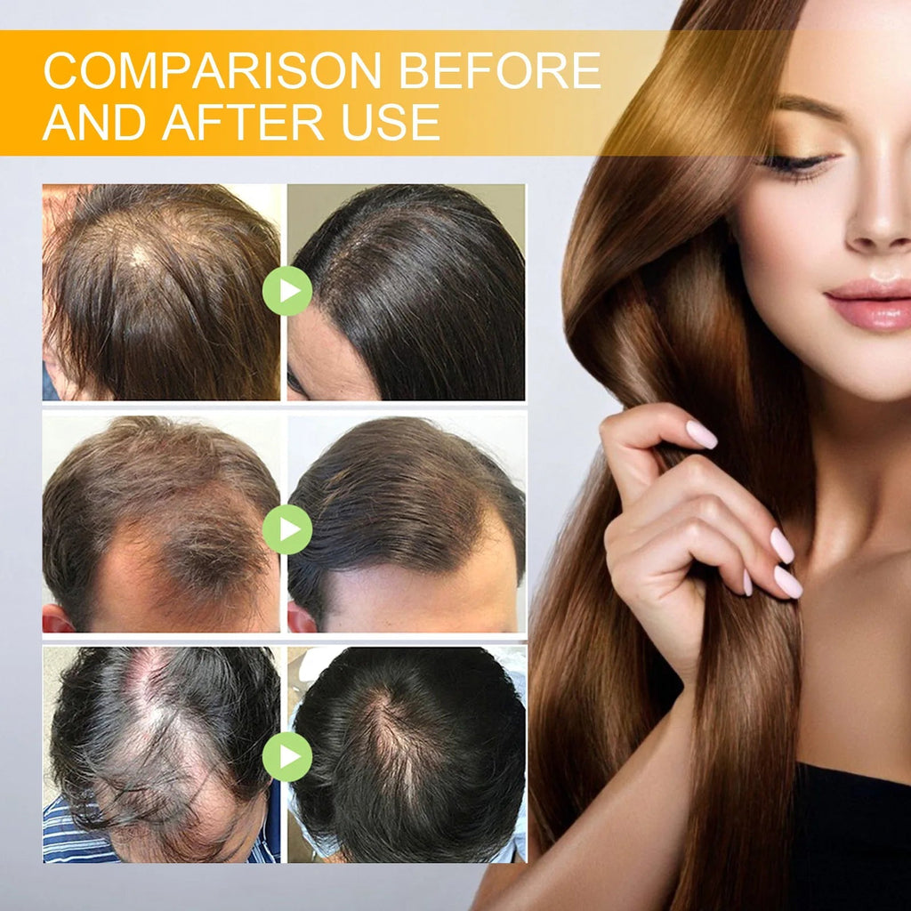 Biotin Scalp Spray Leave In For Thinning Hair 30ml