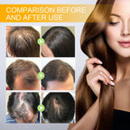 Biotin Scalp Spray Leave In For Thinning Hair 30ml