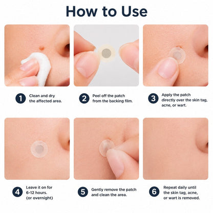 Set of microneedle blemish patches with packaging displayed neatly